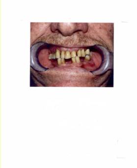 לפני תחילת הטיפול